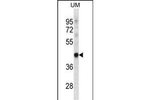TRUB1 anticorps  (AA 152-180)