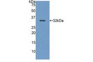 Western blot analysis of recombinant Human LRP5. (LRP5 anticorps  (AA 769-1016))