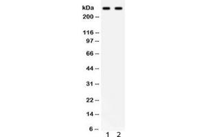 Western blot testing of 1) human HeLa and 2) SW620 lysate with ITPR3 antibody. (ITPR3 anticorps)