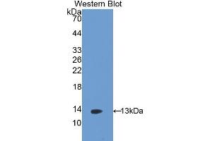 Western Blotting (WB) image for anti-Selectin P (Granule Membrane Protein 140kDa, Antigen CD62) (SELP) (AA 58-158) antibody (ABIN1173198) (P-Selectin anticorps  (AA 58-158))
