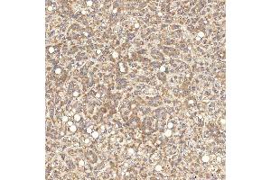 IHC analysis of SGCE using anti-SGCE antibody (ABIN7601544). (SGCE anticorps  (AA 38-407))