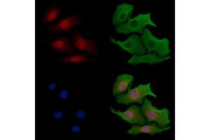ABIN6257304 and ABIN6273553 staining Hela cells by IF/ICC. (ZBTB33 anticorps  (N-Term))