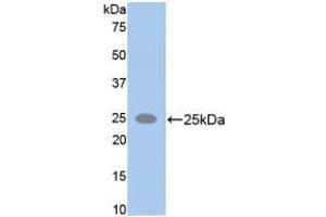 Western blot analysis of recombinant Rat SPTAN1. (SPTAN1 anticorps  (AA 2071-2269))