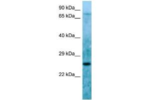 Host: Rabbit Target Name: C11orf48 Sample Type: HepG2 Whole Cell lysates Antibody Dilution: 1. (C11orf48 anticorps  (C-Term))
