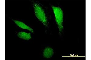 Immunofluorescence of purified MaxPab antibody to DNASE2 on HeLa cell.
