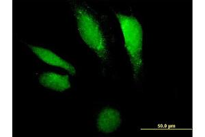 Immunofluorescence of purified MaxPab antibody to DNASE2 on HeLa cell. (DNASE2 anticorps  (AA 1-360))