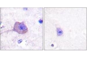 Immunohistochemistry analysis of paraffin-embedded human brain tissue, using AMPK beta1 (Ab-181) Antibody.