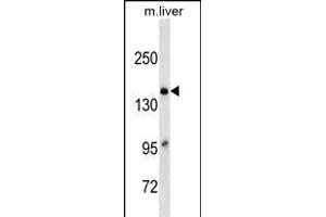 A2M Antibody (C-term)(Ascites) ABIN1539961 western blot analysis in mouse Liver tissue lysates (35 μg/lane). (alpha 2 Macroglobulin anticorps  (C-Term))
