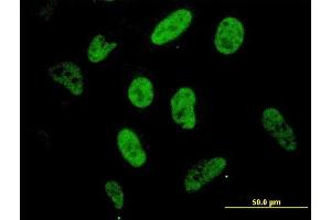 Immunofluorescence of monoclonal antibody to SP1 on HeLa cell.
