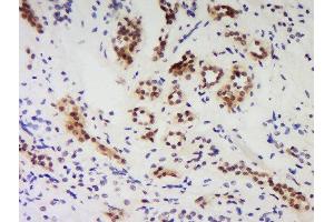 Formalin-fixed and paraffin embedded human kidney labeled with Anti-PNUTS/PPP1R10 Polyclonal Antibody Unconjugated  at 1:200 followed by conjugation to the secondary antibody and DAB staining.