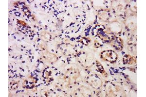 Formalin-fixed and paraffin embedded human kidney labeled with Anti-Caspase-6 Polyclonal Antibody, Unconjugated  at 1:200 followed by conjugation to the secondary antibody and DAB staining. (Caspase 6 anticorps  (AA 151-250))
