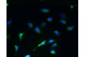 Immunofluorescent analysis of U251 cells using ABIN7168731 at dilution of 1:100 and Alexa Fluor 488-congugated AffiniPure Goat Anti-Rabbit IgG(H+L)