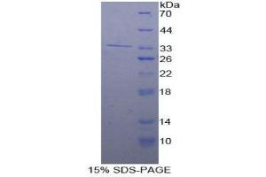 SDS-PAGE (SDS) image for Interferon Regulatory Factor 4 (IRF4) (AA 175-433) protein (His tag) (ABIN1879699)