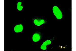 Immunofluorescence of monoclonal antibody to STAT6 on HeLa cell. (STAT6 anticorps  (AA 694-801))
