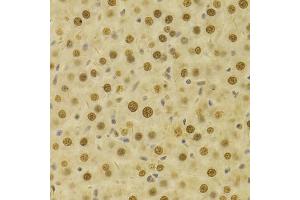 Immunohistochemistry of paraffin-embedded rat liver using HDGF Antibody (ABIN1876535) at dilution of 1:100 (40x lens). (HDGF anticorps)
