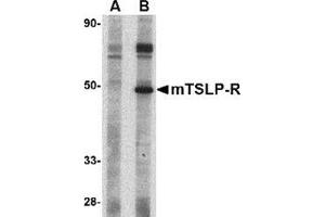 Western blot analysis of TSLP Receptor in mouse heart tissue lysate with this product at 1 μg/ml in (A) the presence and (B) the absence of blocking peptide. (CRLF2 anticorps  (Center))