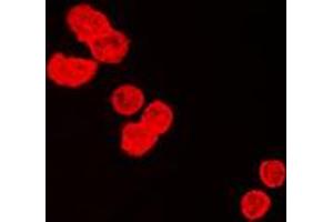 Immunofluorescent analysis of BUB3 staining in HeLa cells. (BUB3 anticorps  (C-Term))