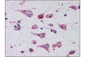 Immunohistochemistry (IHC) image for anti-Cathepsin D (CTSD) (AA 21-412) antibody (ABIN317502) (Cathepsin D anticorps  (AA 21-412))