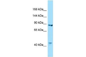 WB Suggested Anti-IPO8 Antibody Titration: 1. (Importin 8 anticorps  (C-Term))