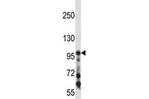 COL1A1 antibody western blot analysis in mouse kidney tissue lysate (COL1A1 anticorps  (AA 1077-1106))