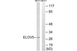 Western blot analysis of extracts from MCF-7 cells, using ELOVL5 antibody. (ELOVL5 anticorps)