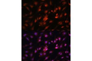 Immunofluorescence analysis of C6 cells using c-Jun antibody (ABIN6131074, ABIN6142670, ABIN6142671 and ABIN6215187) at dilution of 1:100.