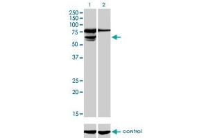 Western blot analysis of PGM3 over-expressed 293 cell line, cotransfected with PGM3 Validated Chimera RNAi (Lane 2) or non-transfected control (Lane 1). (Phosphoglucomutase 3 anticorps  (AA 1-542))