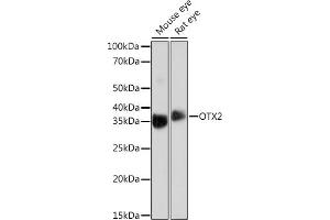 Western blot analysis of extracts of various cell lines, using OTX2 Rabbit mAb (ABIN7269116) at 1:1000 dilution.