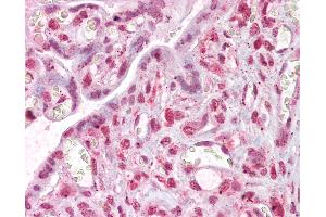 Anti-MLX antibody IHC of human placenta. (MLX anticorps  (AA 217-231))