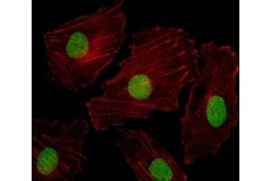 Fluorescent image of HUVEC cells stained with ISL2 antibody.