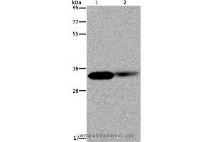 Western blot analysis of Human kidney and mouse lung tissue, using LIMS1 Polyclonal Antibody at dilution of 1:200