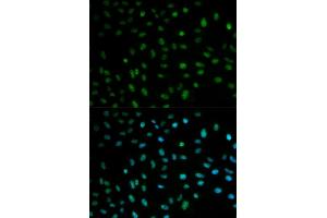Immunofluorescence analysis of MCF7 cell using ELAVL1 antibody.