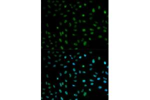 Immunofluorescence analysis of MCF7 cell using ELAVL1 antibody. (ELAVL1 anticorps  (AA 1-326))