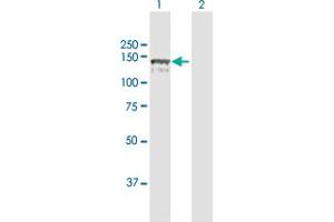 Western Blot analysis of CC2D1A expression in transfected 293T cell line by CC2D1A MaxPab polyclonal antibody. (CC2D1A anticorps  (AA 1-951))