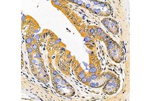 Immunohistochemistry of paraffin embedded rat rectum using LTF (ABIN7074457) at dilution of 1: 700 (350x lens)