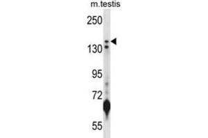 Western Blotting (WB) image for anti-Lysine (K)-Specific Demethylase 5B (KDM5B) antibody (ABIN2998014) (KDM5B anticorps)