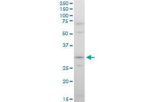 STOM polyclonal antibody (A01), Lot # 060717JCS1.