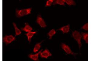 ABIN6266872 staining HepG2 by IF/ICC. (COL14A1 anticorps  (C-Term))