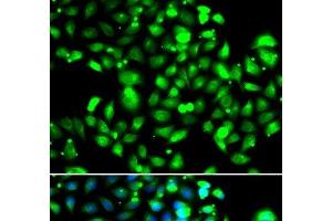 Immunofluorescence analysis of U2OS cells using GBP1 Polyclonal Antibody (GBP1 anticorps)