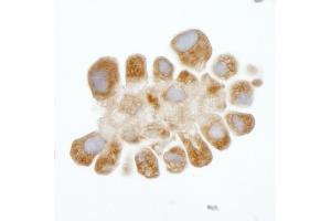 Immunohistochemistry (IHC) image for anti-DEAD (Asp-Glu-Ala-Asp) Box Polypeptide 3, X-Linked (DDX3X) (AA 1-50) antibody (ABIN7448520) (DDX3X anticorps  (AA 1-50))