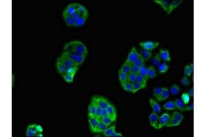 Immunofluorescent analysis of PC-3 cells using ABIN7168699 at dilution of 1:100 and Alexa Fluor 488-congugated AffiniPure Goat Anti-Rabbit IgG(H+L)