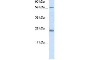 WB Suggested Anti-RHOX11 Antibody Titration:  0. (RHOX11 anticorps  (N-Term))