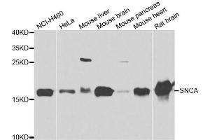 Western blot analysis of extracts of various cell lines, using SNCA antibody. (SNCA anticorps)