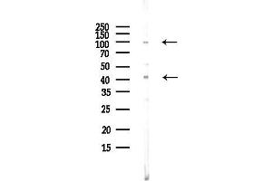 Western blot analysis of lysates from EC304 cells(LPS, 4h treatment), using DAG1 Antibody at 1/1000 dilution.