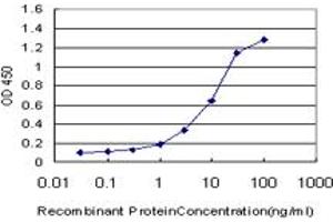 Detection limit for recombinant GST tagged ELAC1 is approximately 0.