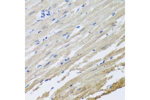 Immunohistochemistry of paraffin-embedded rat heart using SET antibody (ABIN5973657) at dilution of 1/100 (40x lens). (SET/TAF-I anticorps)