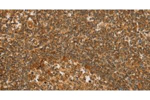 Immunohistochemistry of paraffin-embedded Human tonsil tissue using SLC6A3 Polyclonal Antibody at dilution 1:50 (SLC6A3 anticorps)