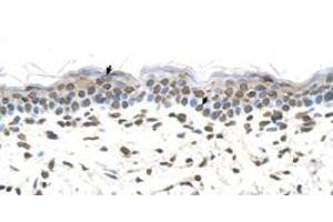 Immunohistochemical staining (Formalin-fixed paraffin-embedded sections) of human skin with FTCD polyclonal antibody  at 4-8 ug/mL working concentration. (FTCD anticorps  (N-Term))