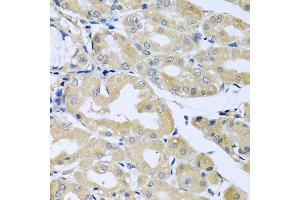 Immunohistochemistry of paraffin-embedded human stomach using HS1BP3 antibody at dilution of 1:100 (x40 lens). (HS1BP3 anticorps)