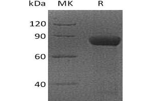 Western Blotting (WB) image for Cytotoxic and Regulatory T Cell Molecule (CRTAM) protein (Fc Tag) (ABIN7320944)